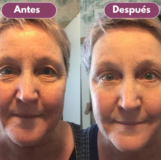 Bálsamo Reafirmante Dr.Melaxín