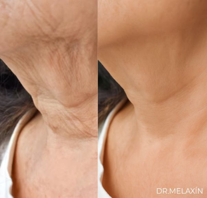 Bálsamo Reafirmante Dr.Melaxín